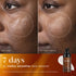C-Tetra® Advanced