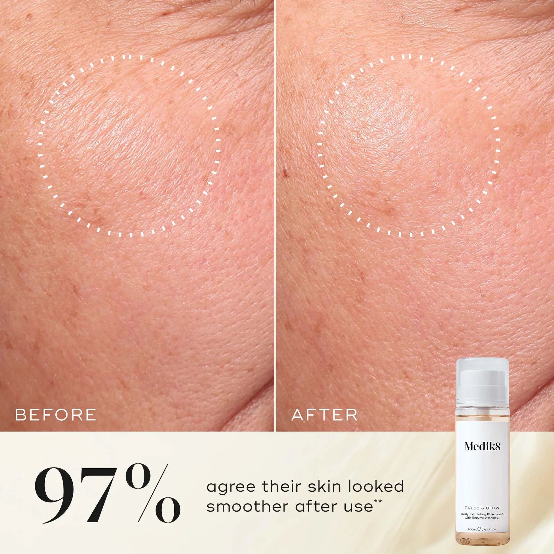 Press & Glow™ (Travel Size) - Medik8.fi