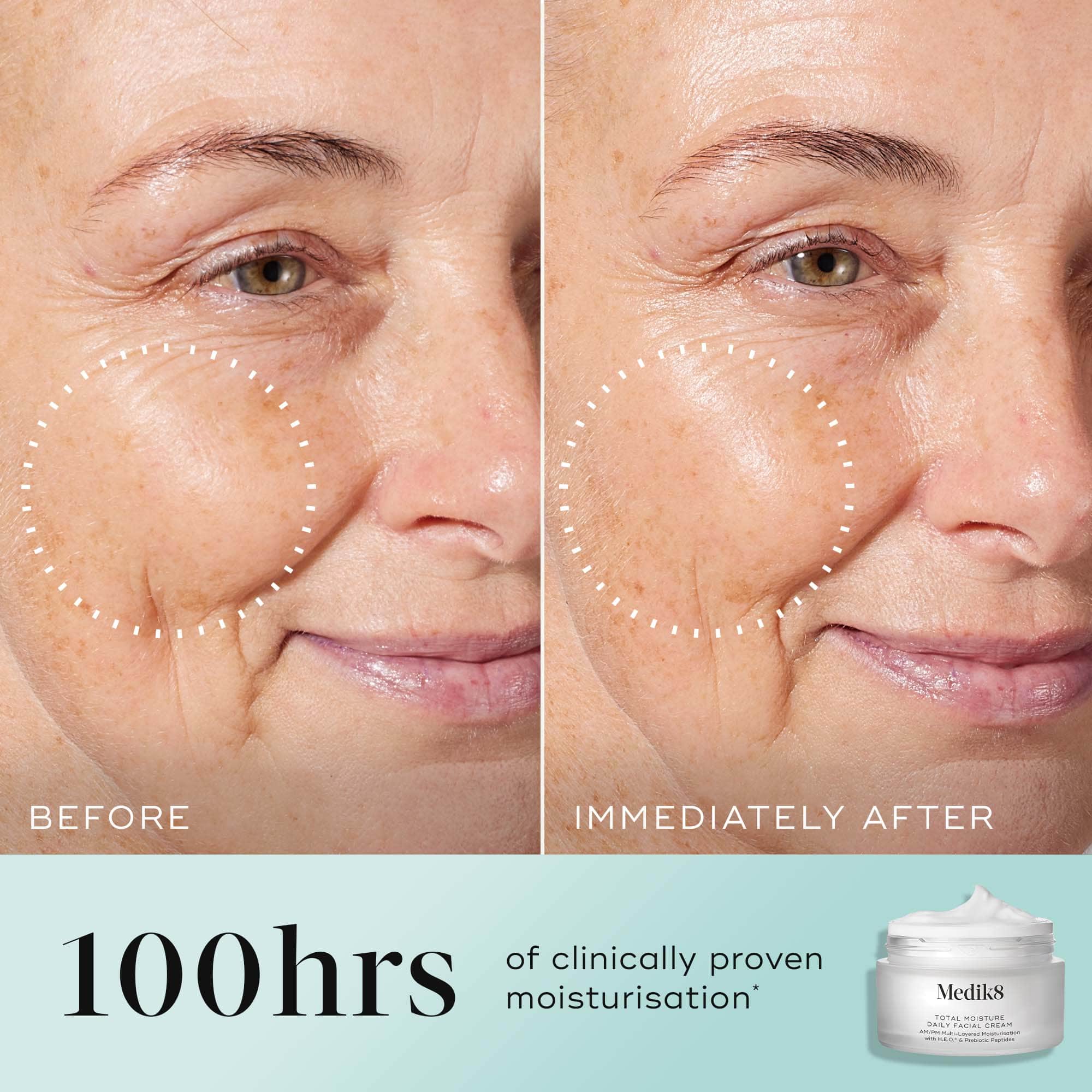 Total Moisture Daily Facial Cream™ - Medik8.fi